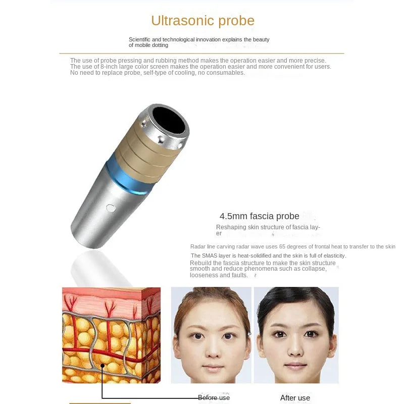 110V/220V Ultrasonic beauty instrument sonar V carving radar line carving face-lift wrinkle anti-aging beauty instrument