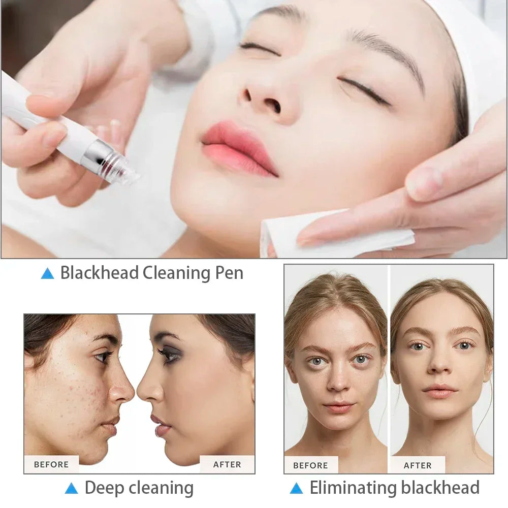 6 in 1 Facial Machine  Hydra Aqua Deep Cleaning Skin Care Device